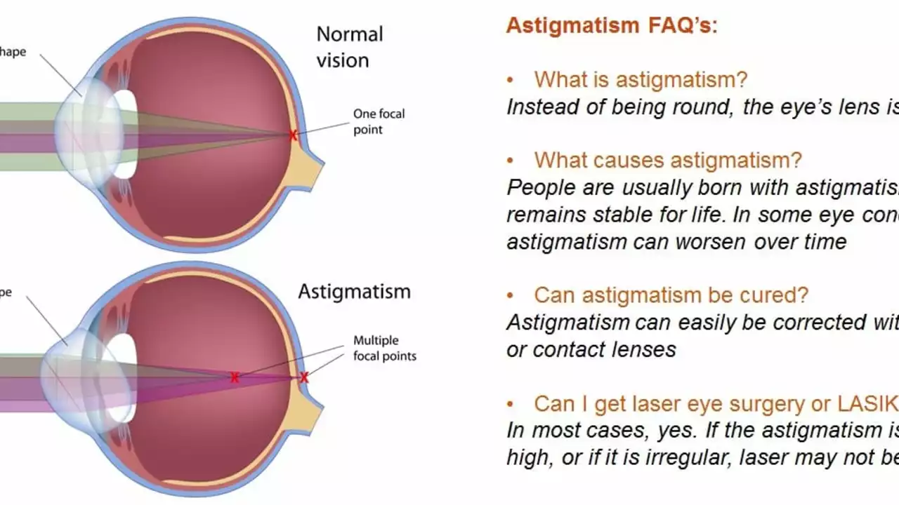 Sambandet mellan högt ögontryck och astigmatism
